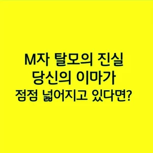 M자 탈모의 진실, 당신의 이마가 점점 넓어지고 있다면?